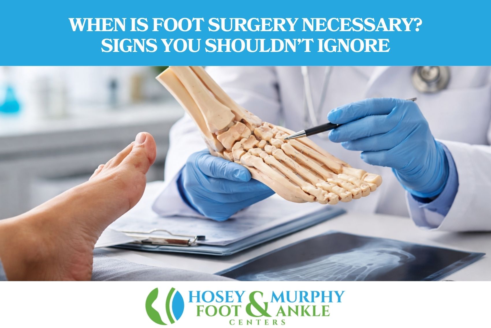 When Is Foot Surgery Necessary Signs You Shouldn’t Ignore